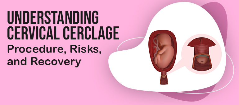 Understanding Cervical Cerclage: Procedure, Risks, and Recovery